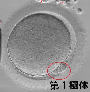 通常の顕微鏡で観察した成熟卵。