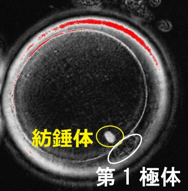 特殊な装置を用いて観察した成熟卵。