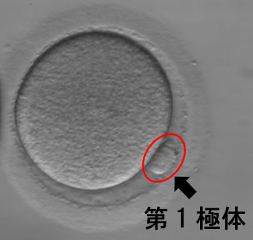 通常の顕微鏡で観察した成熟卵。