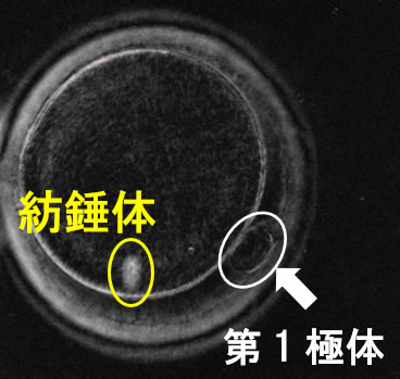 特殊な装置を用いて観察した成熟卵。